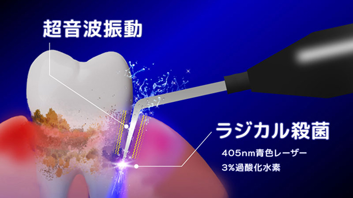 超音波振動とラジカル殺菌