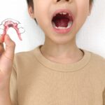 小児矯正の期間は何年かかる？阪神尼崎エリアで後悔しない歯医者の選び方